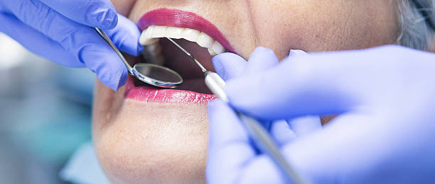Best Urgent Care for Lost Fillings or Crowns in Yuipa, CA