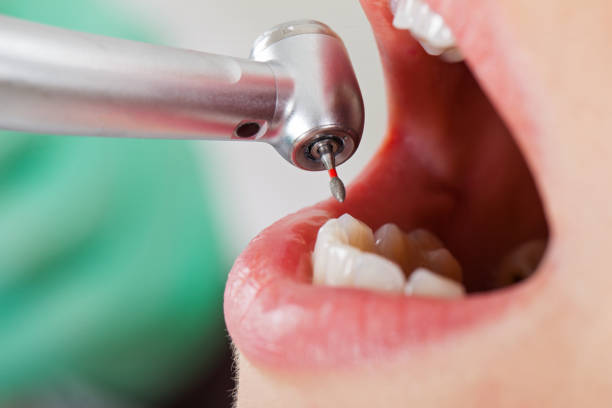 Best Pediatric Emergency Dentist in Yuipa, CA